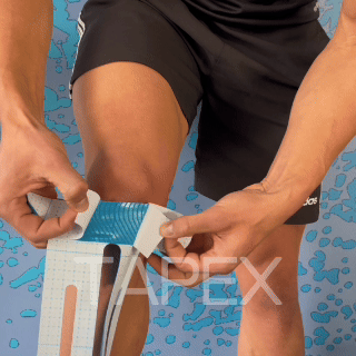 ARTEX™ - Articulation du genou